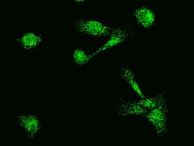 Immunocytochemistry/ Immunofluorescence: MBD3L1 Antibody [NBP2-99004]