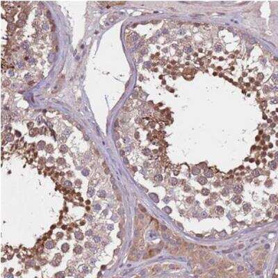 Immunohistochemistry: MBD3L1 Antibody [NBP2-30753]