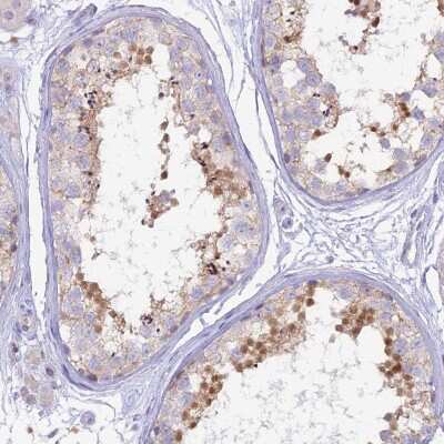 Immunohistochemistry-Paraffin: MBD3L1 Antibody [NBP2-30978]