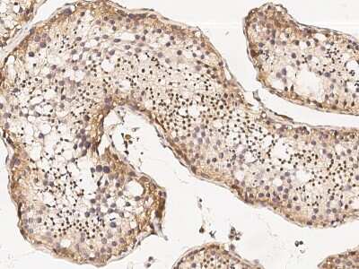 Immunohistochemistry-Paraffin: MBD3L1 Antibody [NBP2-99004]