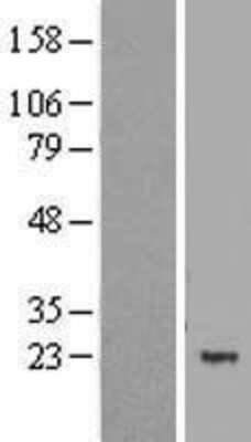 Western Blot: MBD3L1 Overexpression Lysate [NBL1-12925]