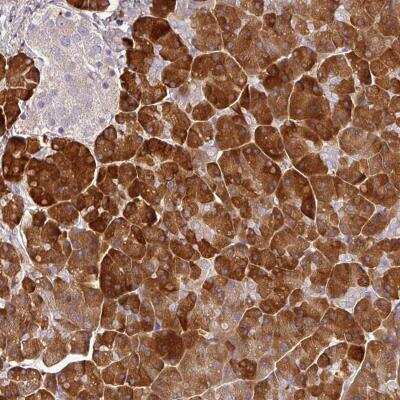 Immunohistochemistry: MBD3L3 Antibody [NBP2-46787]