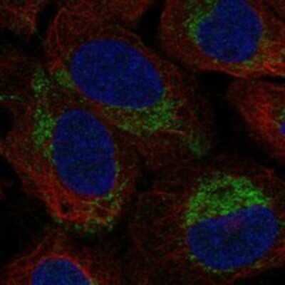 Immunocytochemistry/ Immunofluorescence: MBD3L5 Antibody [NBP3-17166]