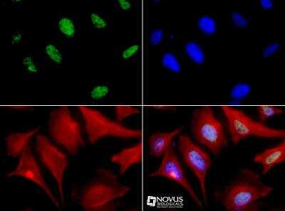 Immunocytochemistry/ Immunofluorescence: MBD4 Antibody - BSA Free [NBP1-91189]