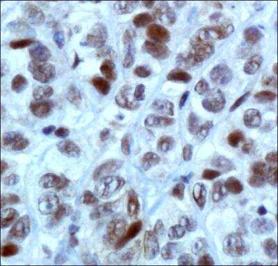 Immunohistochemistry: MBD4 Antibody - BSA Free [NBP1-91189]