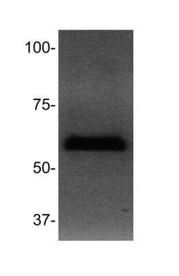 Western Blot: MBD4 Antibody [NBP2-24393]