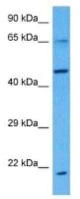 Western Blot: MBD4 Antibody [NBP3-10031]