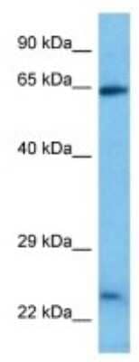 Western Blot: MBD4 Antibody [NBP3-10065]