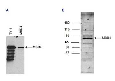 Western Blot: MBD4 Antibody [NBP3-18657]