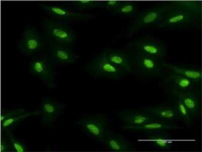 Immunocytochemistry/ Immunofluorescence: MBD5 Antibody (4A12-1B6) [H00055777-M01]