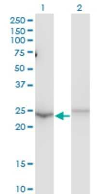 Western Blot: MBD5 Antibody (4A12-1B6) [H00055777-M01]