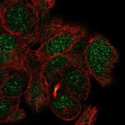 Immunocytochemistry/ Immunofluorescence: MBD5 Antibody [NBP2-54919]