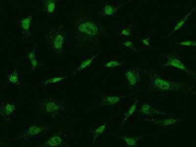 Immunocytochemistry/ Immunofluorescence: MBD5 Antibody [NBP2-99368]