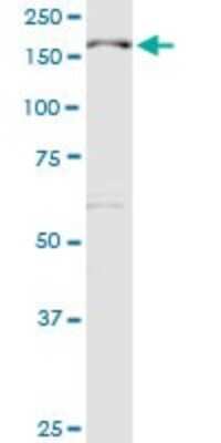 Western Blot: MBD5 Antibody [H00055777-D01P]