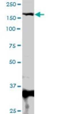 Western Blot: MBD5 Antibody [H00055777-D01P]