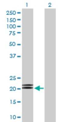 Western Blot: MBD5 Antibody [H00055777-D01P]