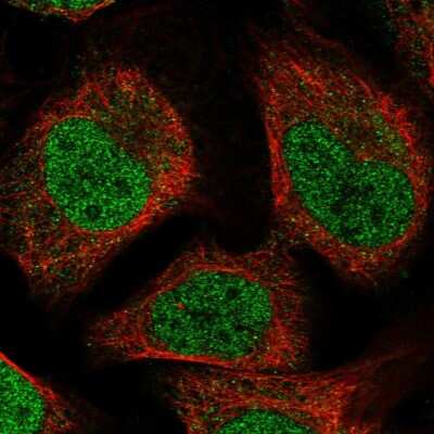 Immunocytochemistry/ Immunofluorescence: MBD6 Antibody [NBP1-81363]