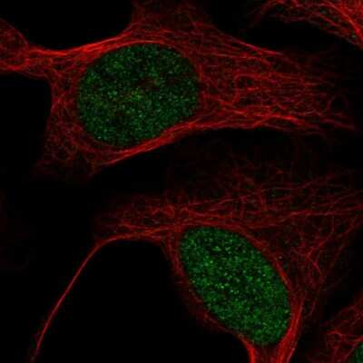 Immunocytochemistry/ Immunofluorescence: MBD6 Antibody [NBP2-38435]