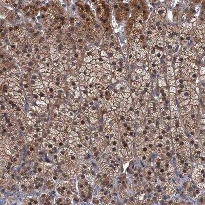 Immunohistochemistry: MBD6 Antibody [NBP1-81363]