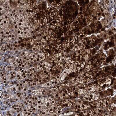 Immunohistochemistry: MBD6 Antibody [NBP2-38435]