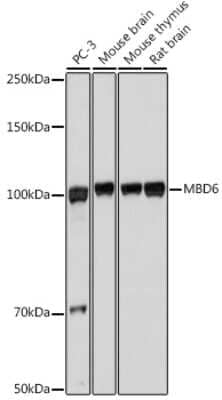 Western Blot: MBD6 AntibodyAzide and BSA Free [NBP3-15957]