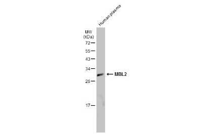 Western Blot: MBL-2 Antibody [NBP3-13134]