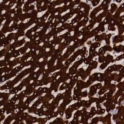 Immunohistochemistry-Paraffin: MBL Antibody [NBP1-85518]