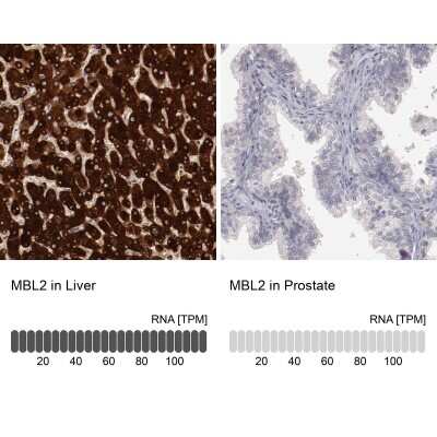 Immunohistochemistry-Paraffin: MBL Antibody [NBP1-85518]