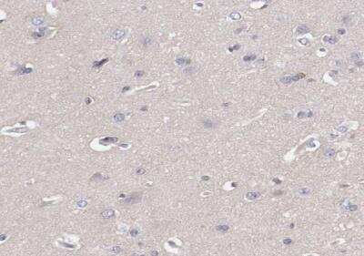 Immunohistochemistry-Paraffin: MBL Antibody [NBP1-85518]