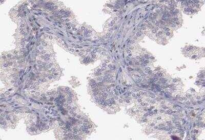 Immunohistochemistry-Paraffin: MBL Antibody [NBP1-85518]