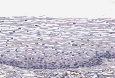Immunohistochemistry-Paraffin: MBL Antibody [NBP1-85518]