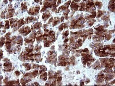 Immunohistochemistry: MBL Antibody (OTI1A12) [NBP2-45758]