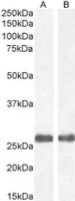 Western Blot: MBL Antibody [NB100-1502]