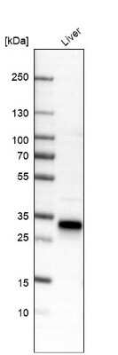 Western Blot: MBL Antibody [NBP1-85518]