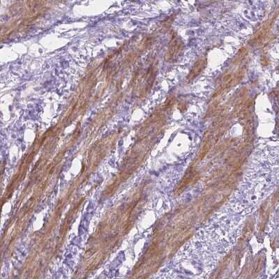 Immunohistochemistry-Paraffin: MBLAC1 Antibody [NBP2-49665]