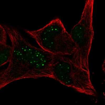 Immunocytochemistry/ Immunofluorescence: MBLAC2 Antibody [NBP2-56926]