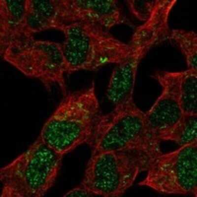 Immunocytochemistry/ Immunofluorescence: MBLAC2 Antibody [NBP3-17391]