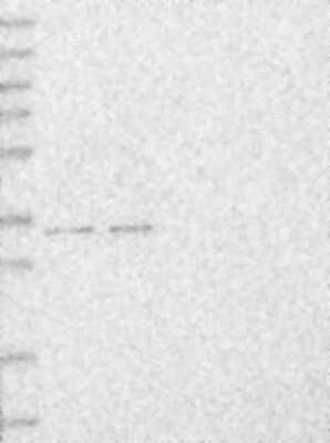 Western Blot: MBLAC2 Antibody [NBP3-17391]