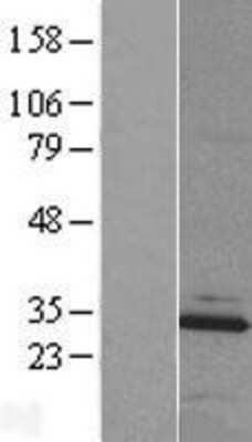 Western Blot: MBLAC2 Overexpression Lysate [NBL1-12581]