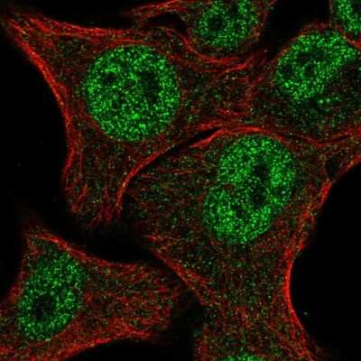 Immunocytochemistry/ Immunofluorescence: MBNL2 Antibody [NBP2-57273]