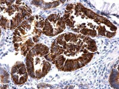 Immunohistochemistry-Paraffin: MBNL2 Antibody [NBP2-43638]