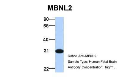 Western Blot: MBNL2 Antibody [NBP1-79451]