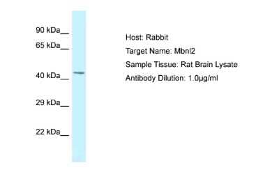 Western Blot: MBNL2 Antibody [NBP2-87783]