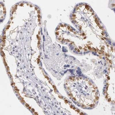 Immunohistochemistry-Paraffin: MBNL3 Antibody [NBP1-85635]