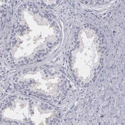Immunohistochemistry-Paraffin: MBNL3 Antibody [NBP1-85635]
