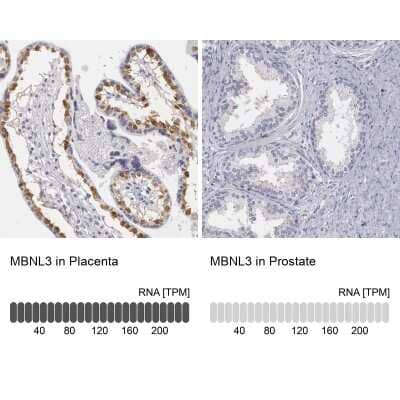 Immunohistochemistry-Paraffin: MBNL3 Antibody [NBP1-85635]