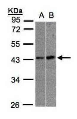 Western Blot: MBNL3 Antibody [NBP1-32575]