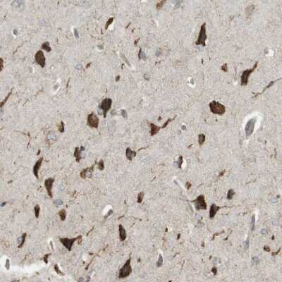 Immunohistochemistry-Paraffin: MBOAT2 Antibody [NBP1-82236]