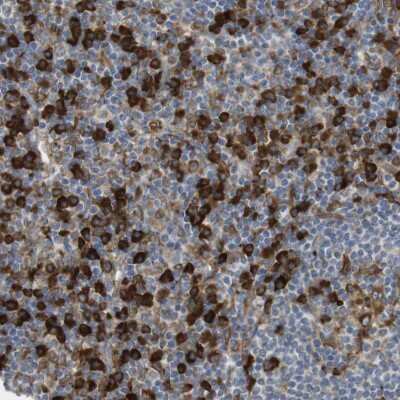 Immunohistochemistry-Paraffin: MBOAT2 Antibody [NBP1-82236]