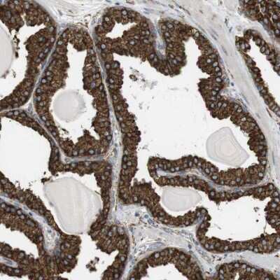 Immunohistochemistry-Paraffin: MBOAT2 Antibody [NBP1-82236]
